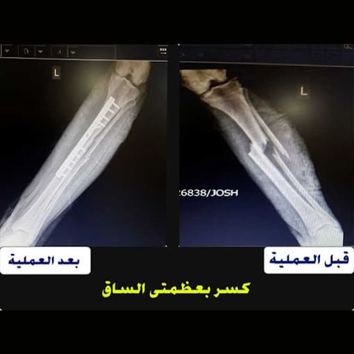 dr-maher-el-qamhawy-clinic-consultant-orthopedic-surgery-joints-photo_210278_2020_sh_01