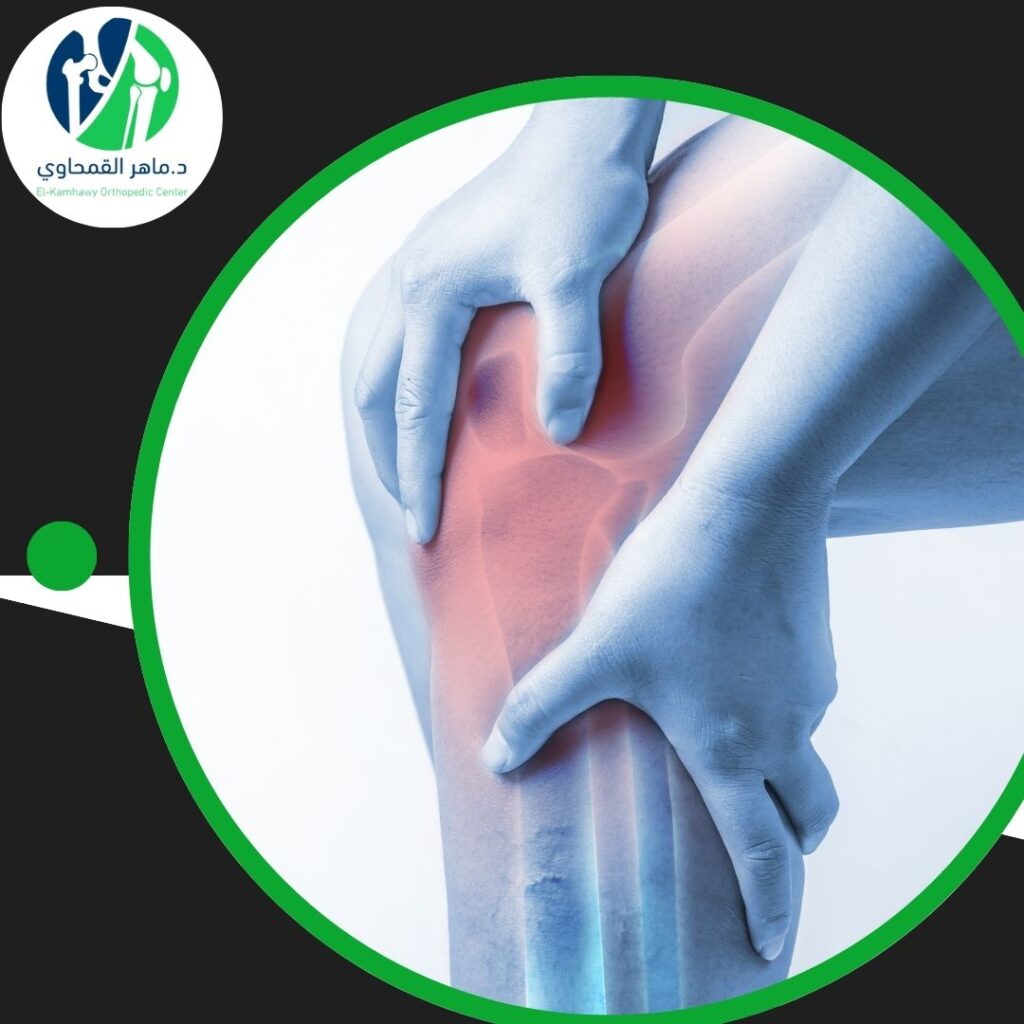 ما هو علاج التهاب مفصل الركبة؟