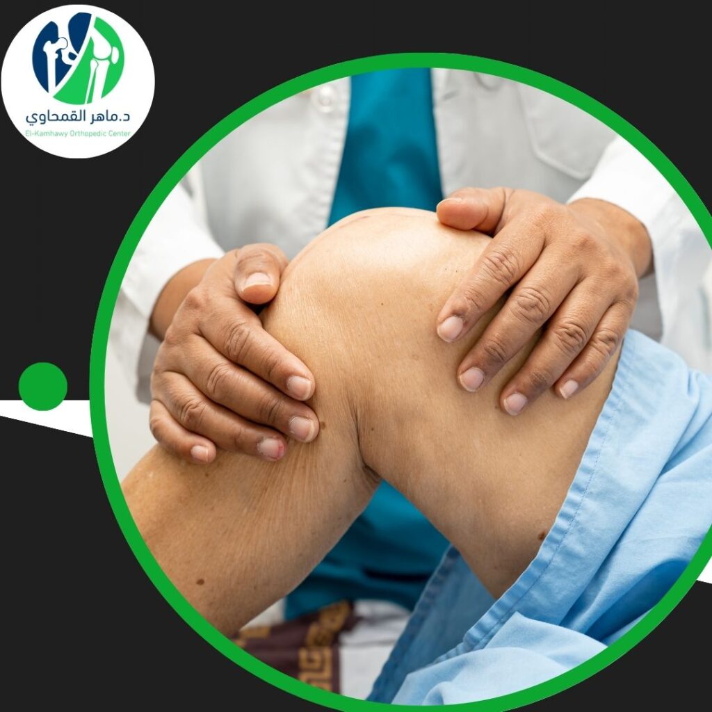 ما هو علاج التهاب مفصل الركبة؟