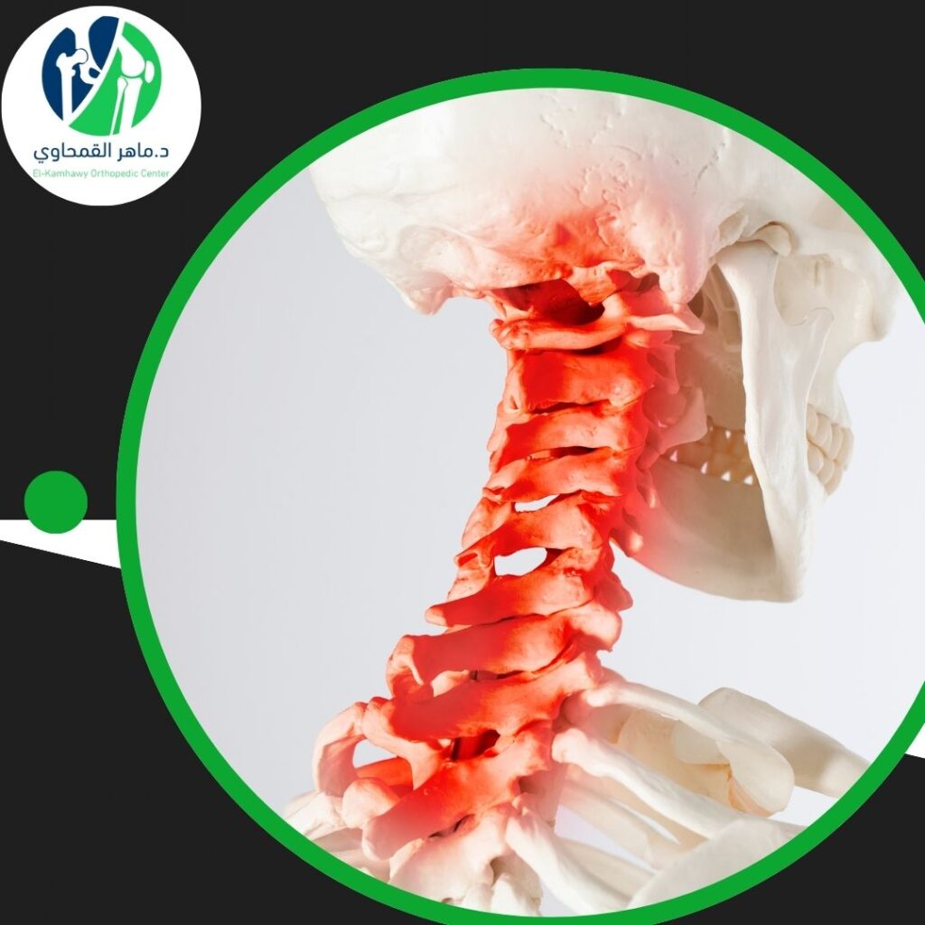 علاج الفقرة الرابعة والخامسة بدون جراحة