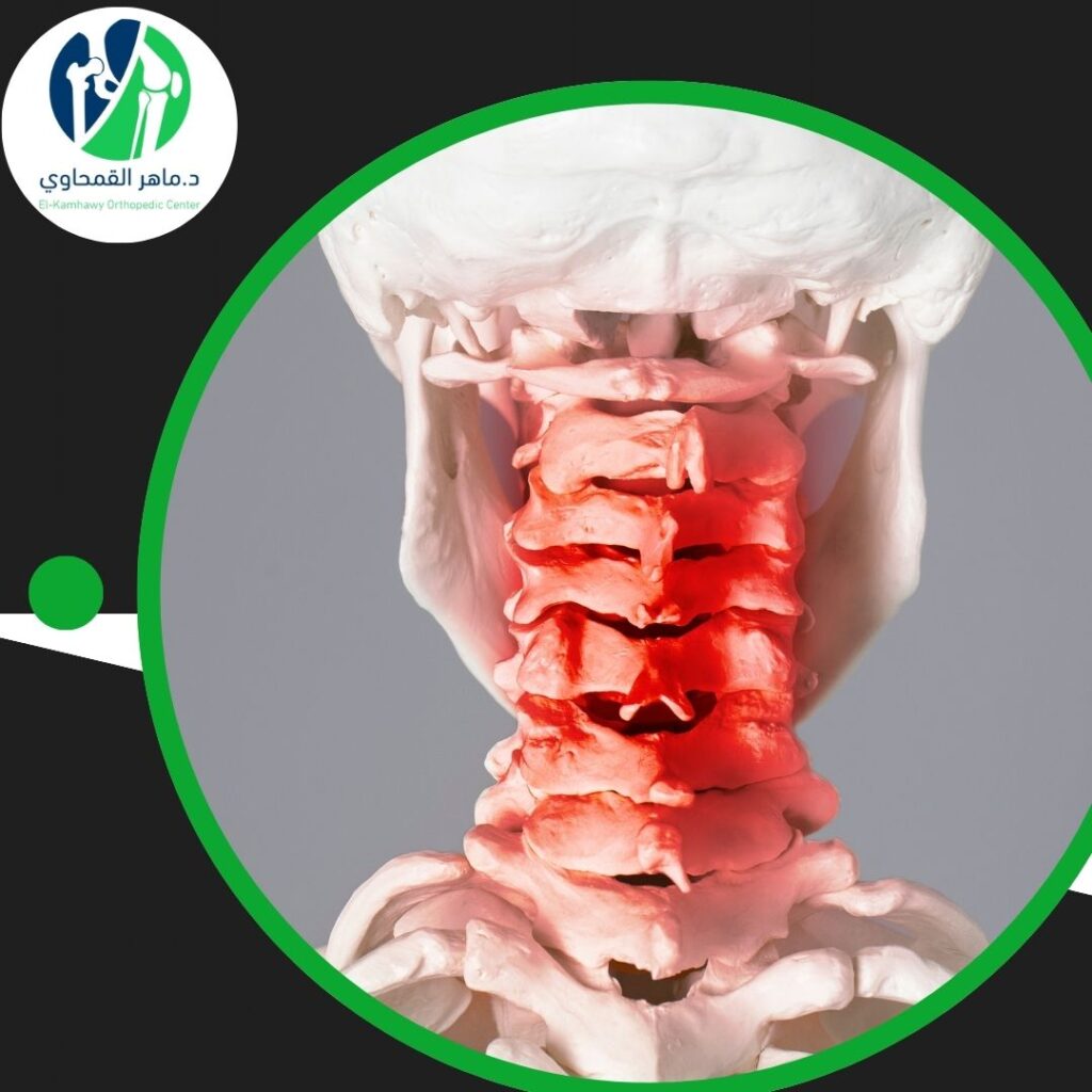 علاج الفقرة الرابعة والخامسة بدون جراحة (2)