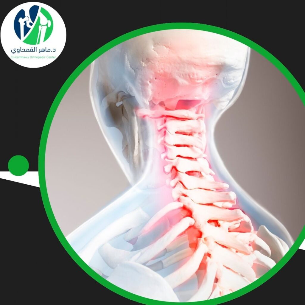 عملية تثبيت الفقرات (1)