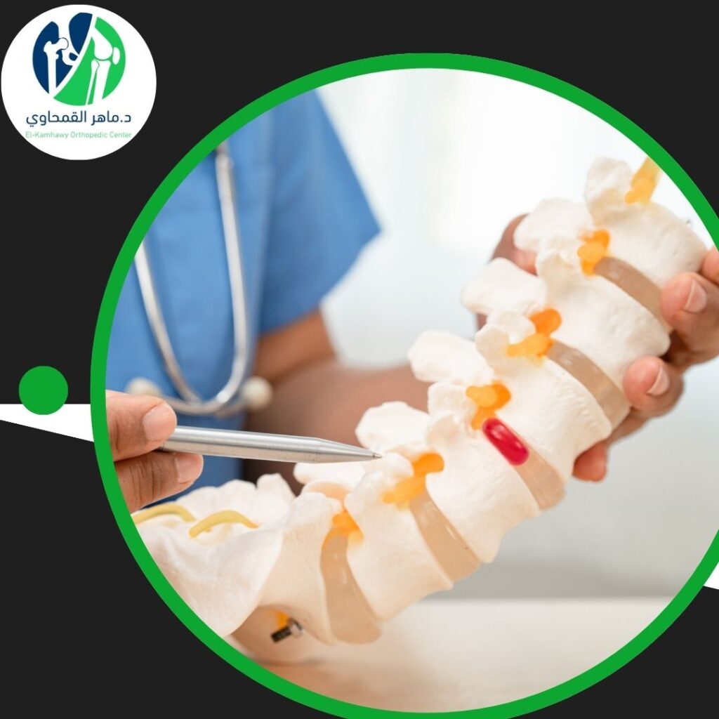 عملية تثبيت الفقرات