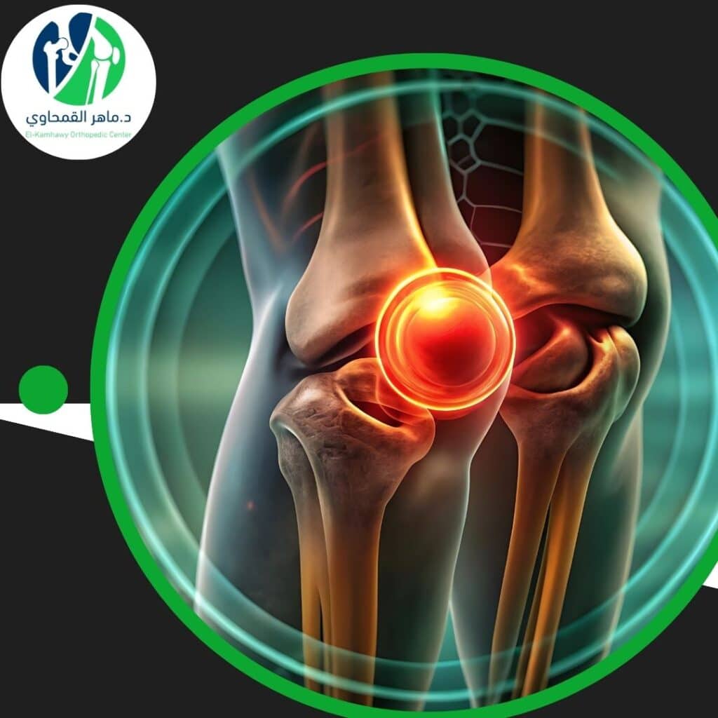 أفضل دكتور عظام تخصص ركبة في مصر- التشخيص والعلاج الحديث 4 أفضل دكتور عظام تخصص ركبة