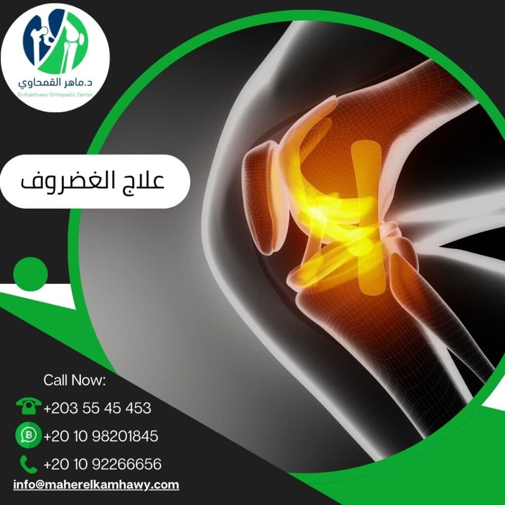 أفضل دكتور علاج الغضروف في الإسكندرية