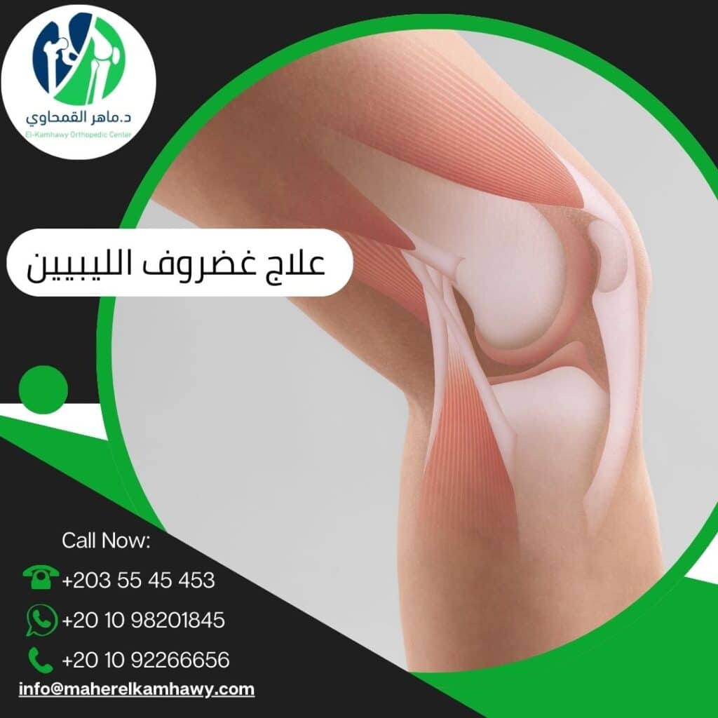 أفضل دكتور علاج غضروف لليبيين