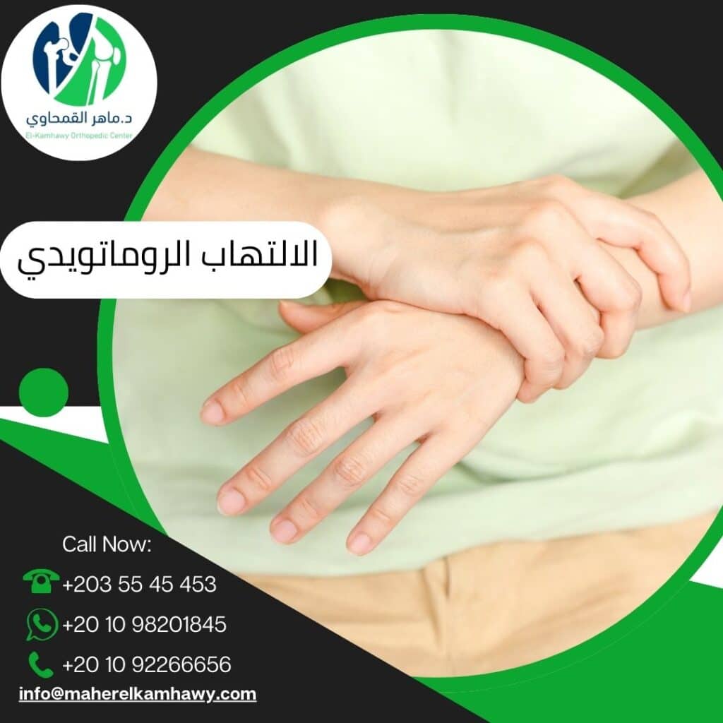 التهاب المفاصل الروماتويدي (2)