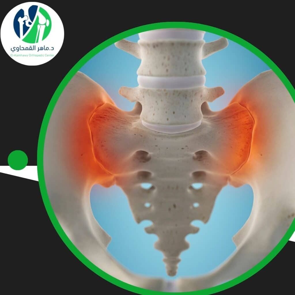 علاج التهاب المفصل الحرقفي العجزي 3 علاج التهاب المفصل الحرقفي العجزي