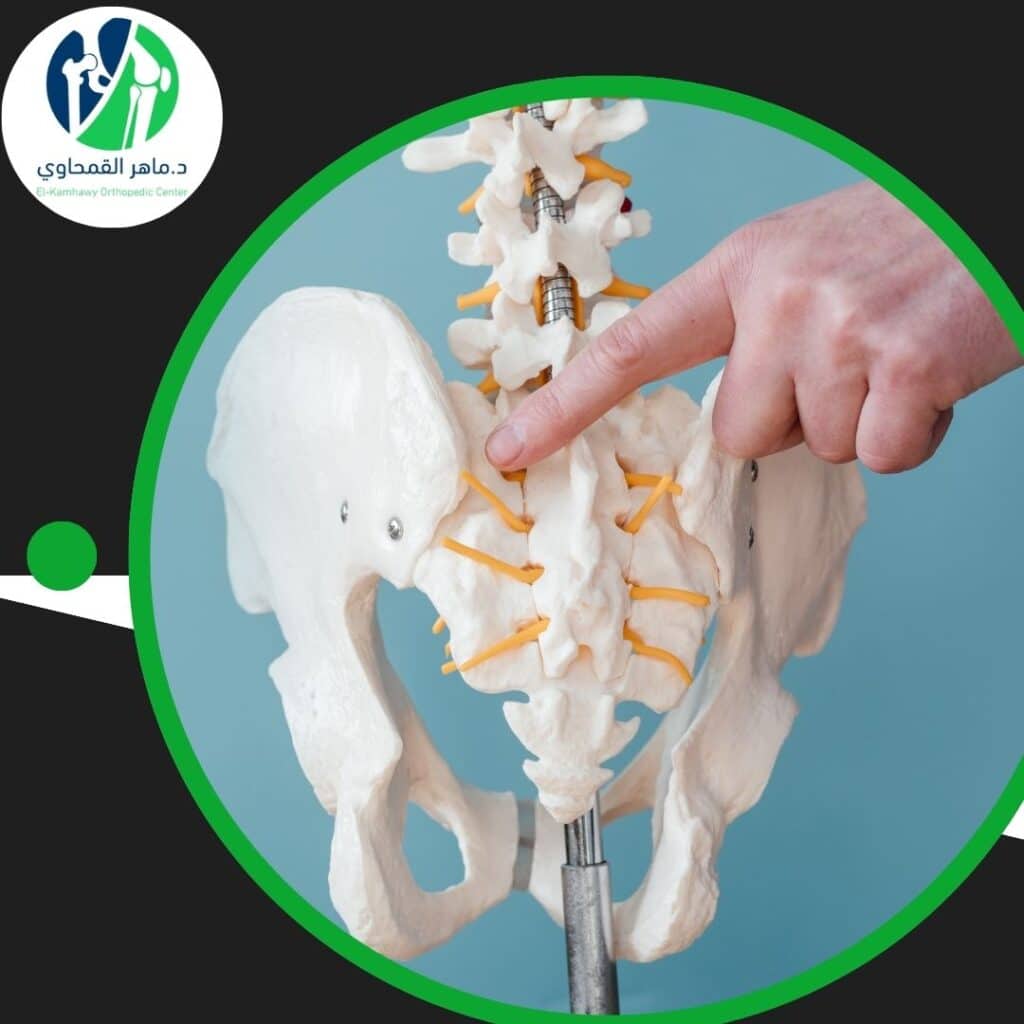 علاج التهاب المفصل الحرقفي العجزي 4 التهاب المفصل الحرقفي العجزي