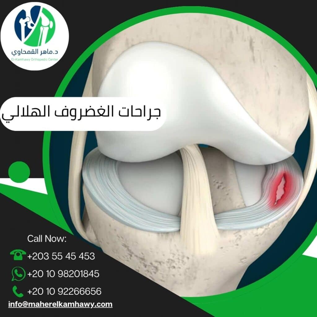 دكتور جراحات الركبة الغضروف الهلالي