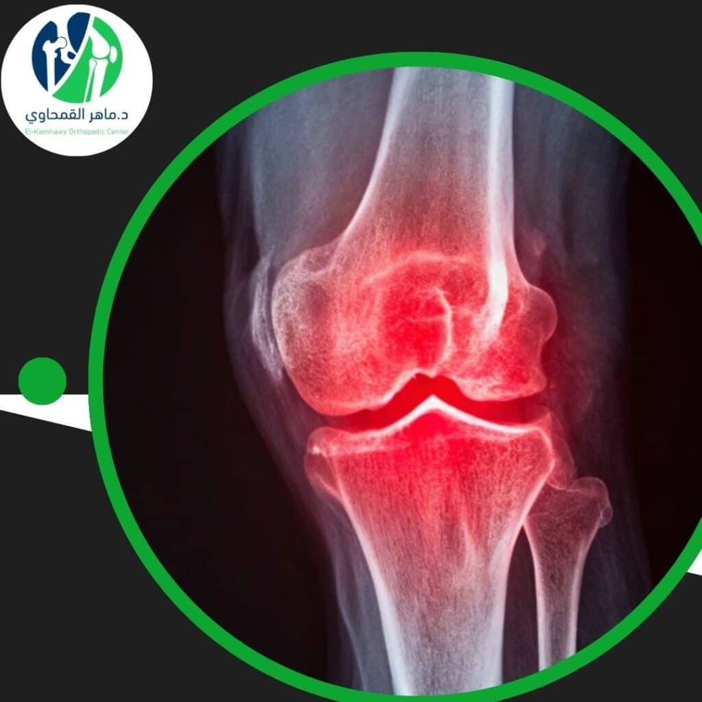 علاج الغضروف بالليزر 3 علاج الغضروف بالليزر (1)