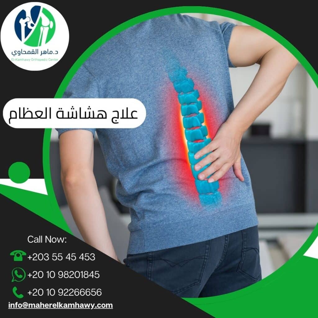 علاج هشاشة العظام