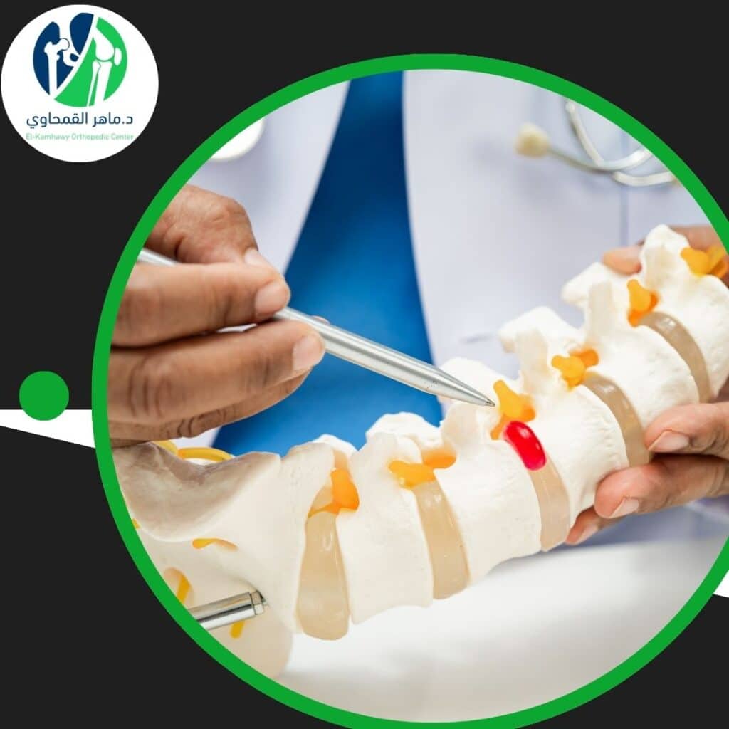 تعرف على مضاعفات اختناق العصب وعوامل الخطر 3 مضاعفات اختناق العصب وعوامل الخطر