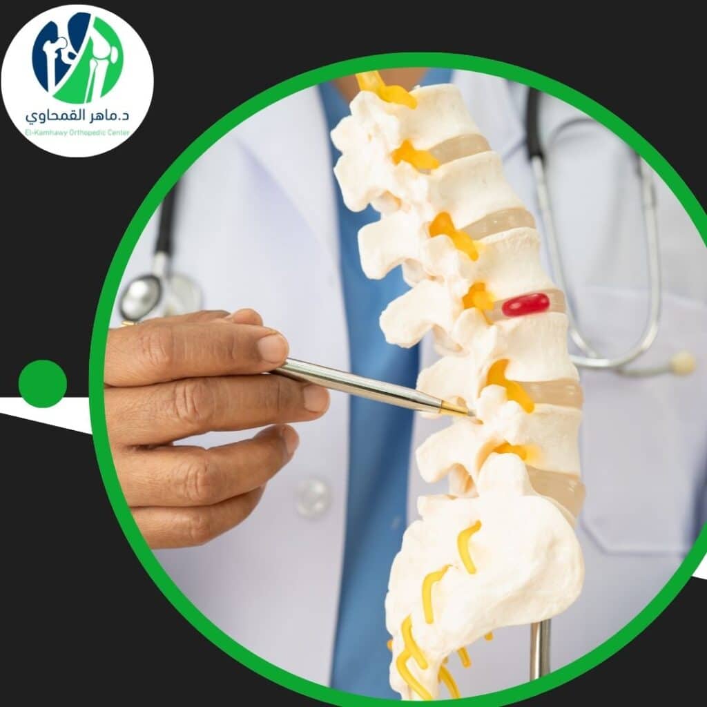 تعرف على مضاعفات اختناق العصب وعوامل الخطر 4 مضاعفات اختناق العصب وعوامل الخطر