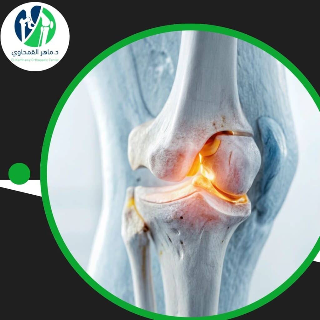 أفضل دكتور علاج غضروف الركبة 4 أفضل دكتور علاج غضروف الركبة (2)