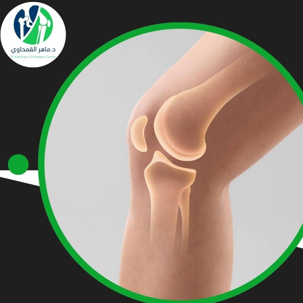 تجربتي مع عملية غضروف الركبة