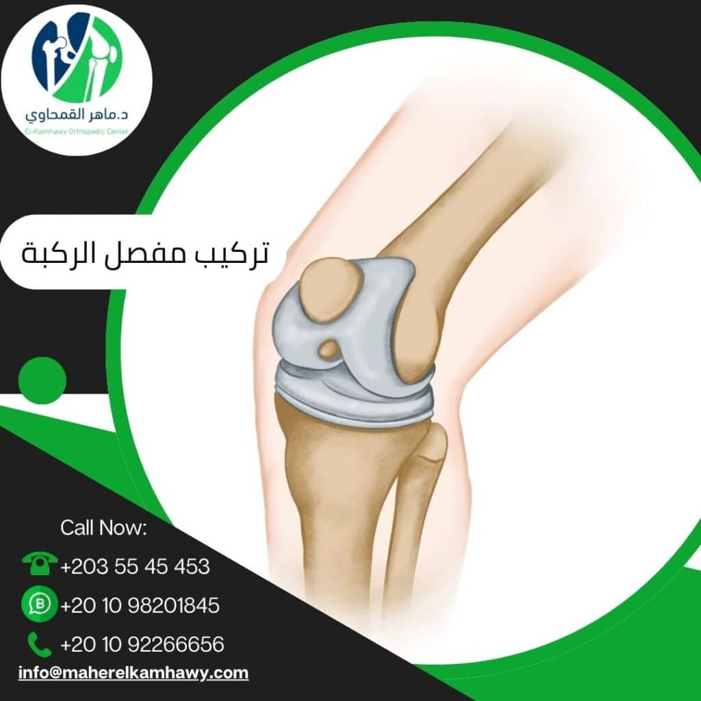 متى يبدأ المشي بعد تركيب مفصل الركبة