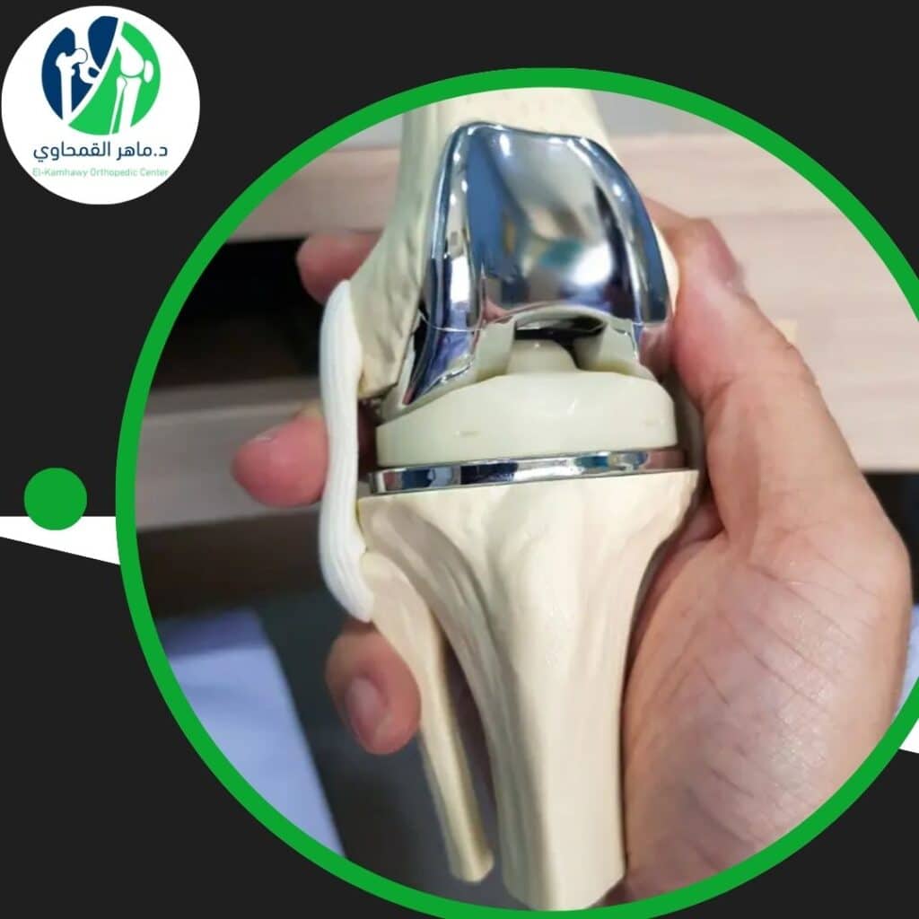 جراحة المفاصل الصناعية