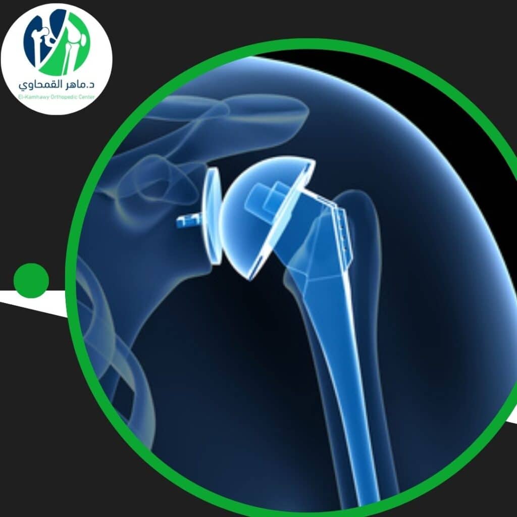 جراحة المفاصل الصناعية