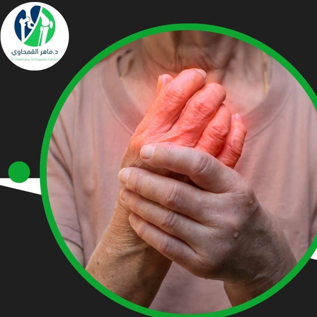 طرق علاج التهاب المفاصل | الأعراض و الأسباب