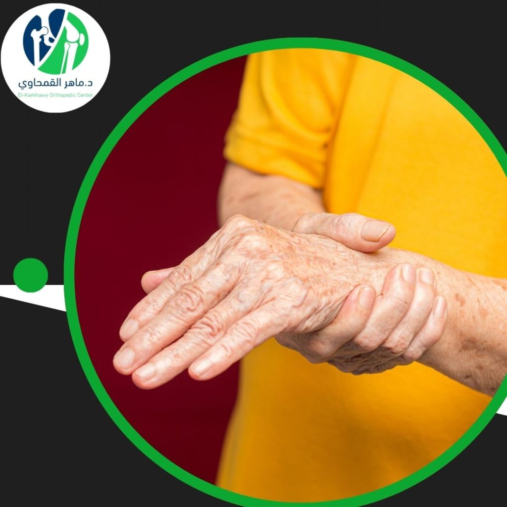 أفضل دكتور لعلاج هشاشة العظام 3 أفضل دكتور لعلاج هشاشة العظام (2)