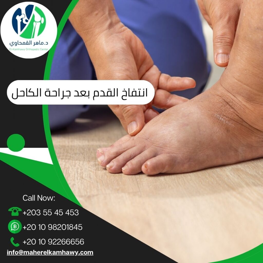 انتفاخ القدم بعد إجراء عملية جراحية في الكاحل 7 انتفاخ القدم بعد إجراء عملية جراحية في الكاحل