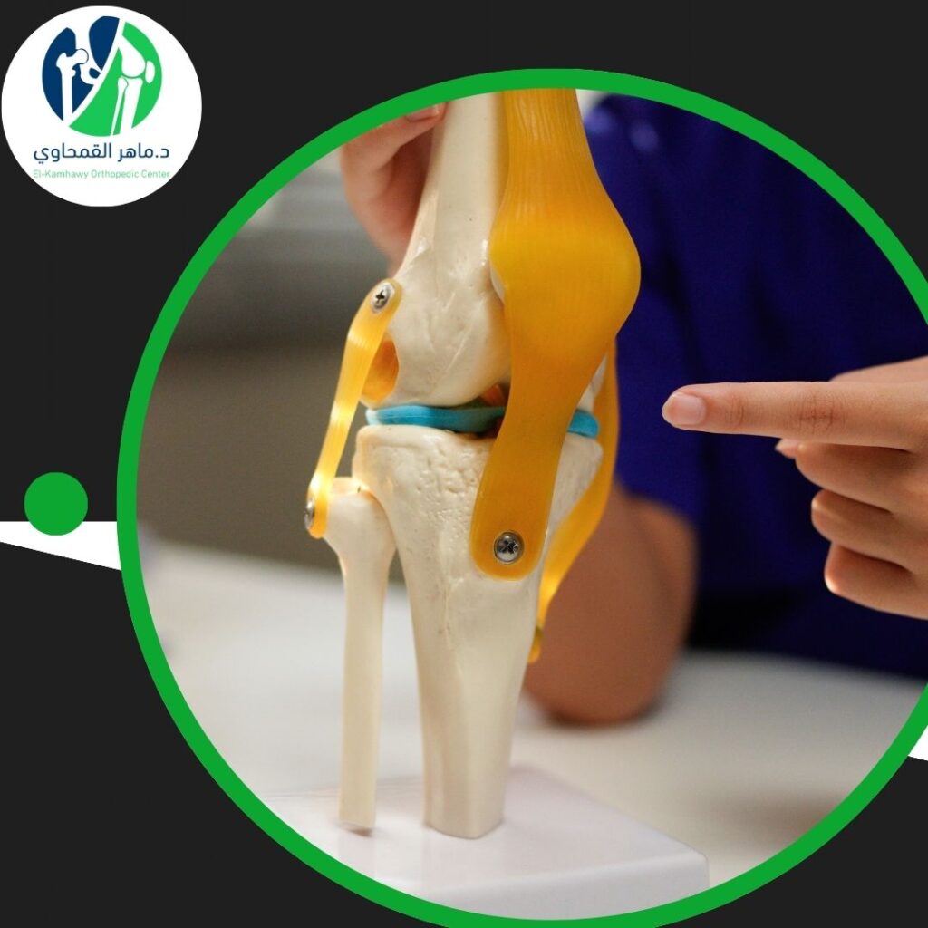 علاج قطع غضروف الركبة بدون جراحة