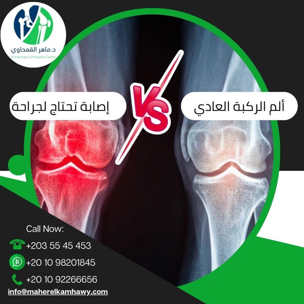 كيف تميز بين ألم الركبة العادي وإصابة تحتاج لجراحة؟