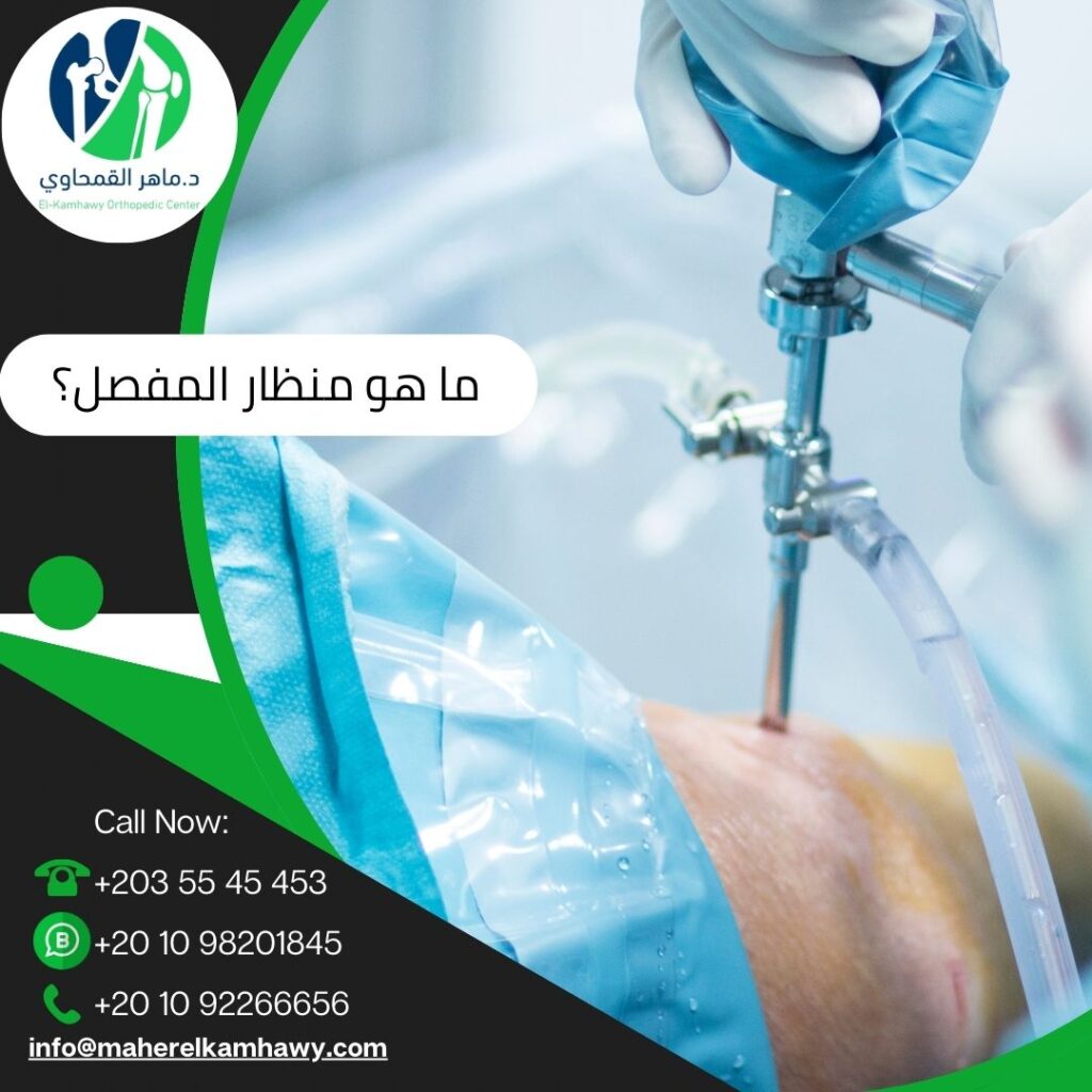 ما هو منظار المفصل؟ ومتى يُستخدم؟ دليل مبسط للمرضى 10 ما هو منظار المفصل؟ ومتى يُستخدم؟ دليل مبسط للمرضى