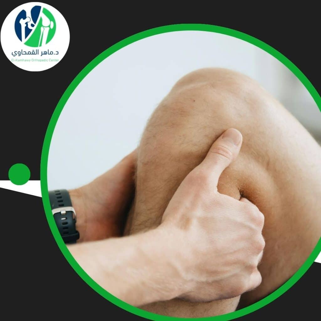 علاج الركبة في مصر للخليجيين دليل كامل بالتكاليف والمستشفيات (1)