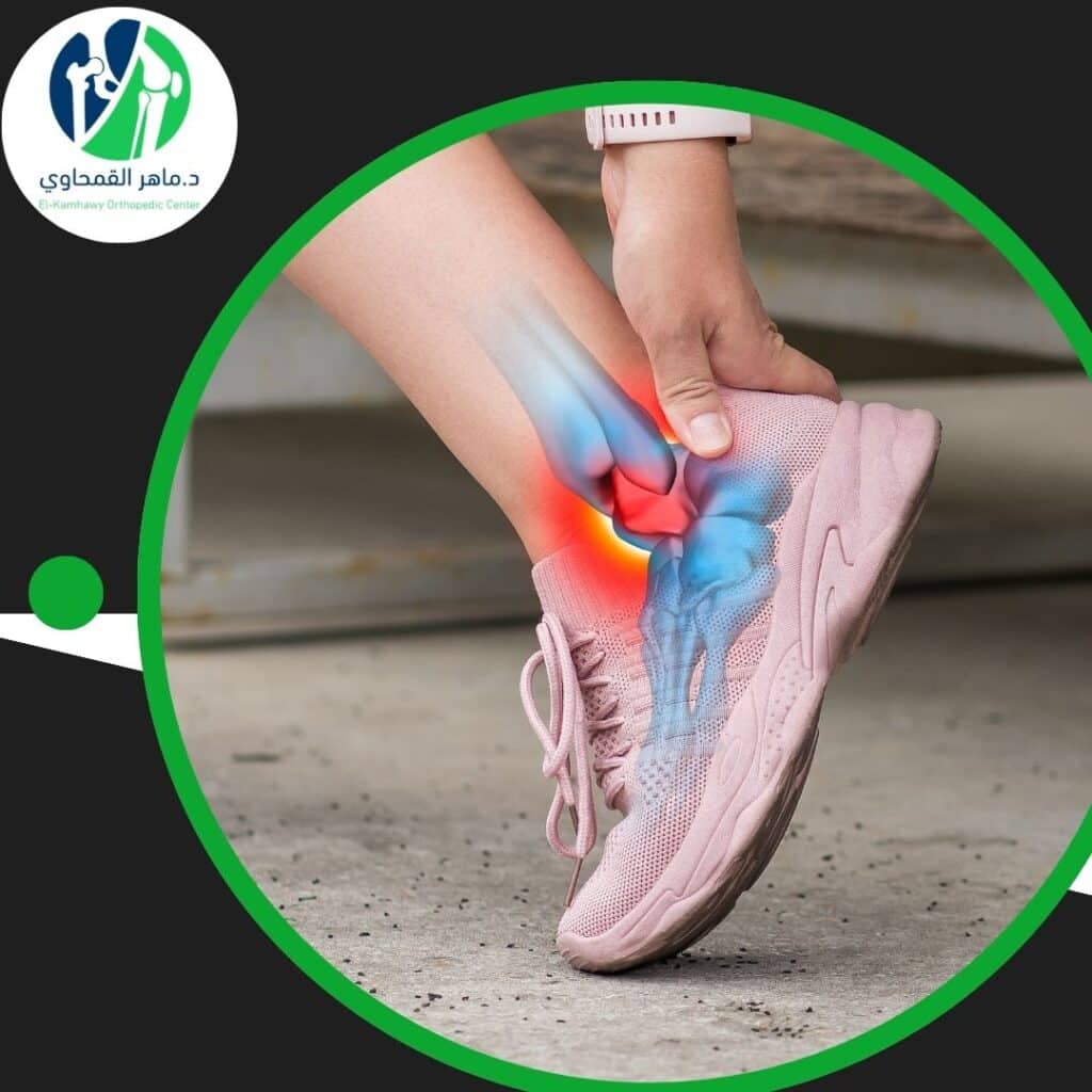 علاج آلام الكعب والشوكة العظمية