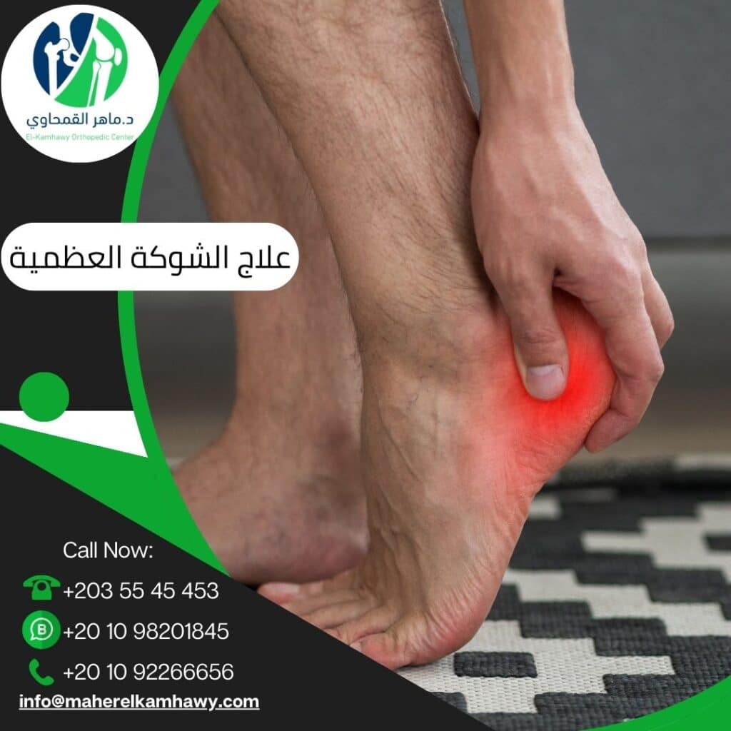 علاج آلام الكعب والشوكة العظمية