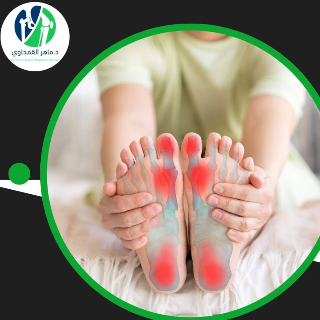 علاج آلام الكعب والشوكة العظمية (2)