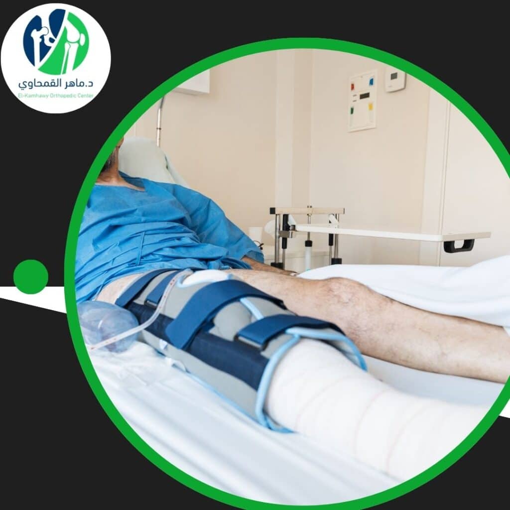 علاج الركبة للمرضى الليبيين في الإسكندرية (1)