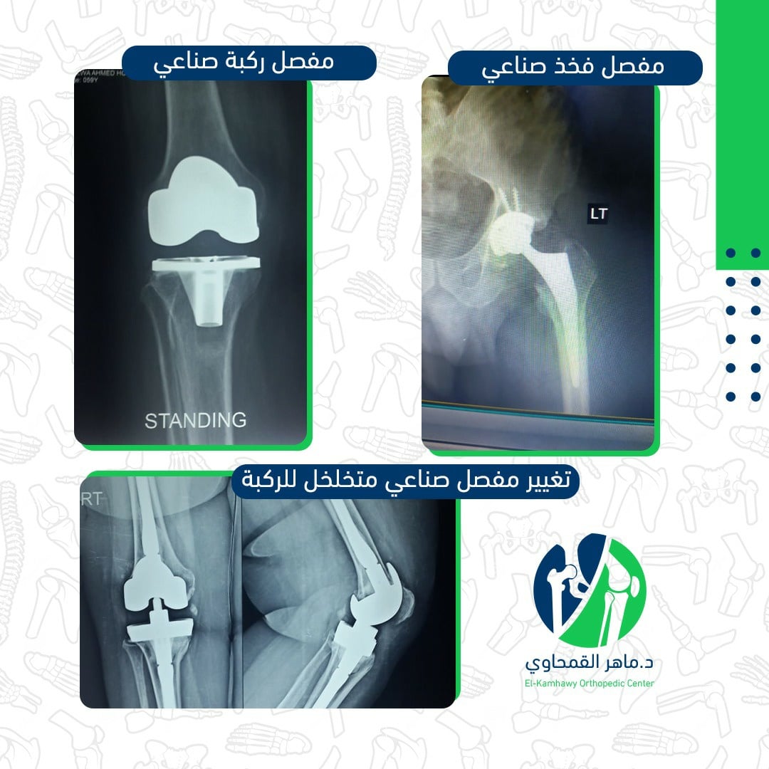 مركز د.ماهر القمحاوي لجراحة العظام والمفاصل مكتبة الميديا