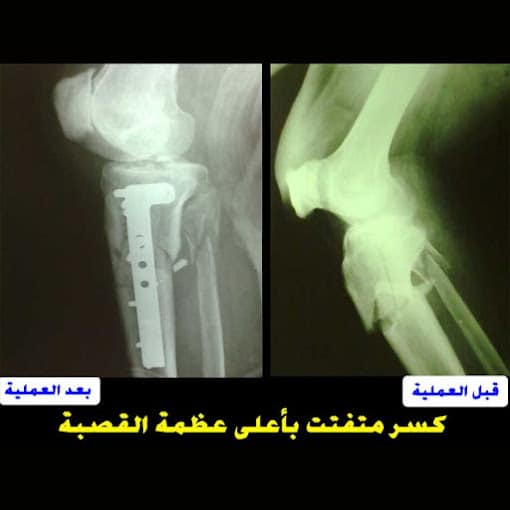 dr-maher-el-qamhawy-clinic-consultant-orthopedic-surgery-joints-photo_210278_2020_sh_10