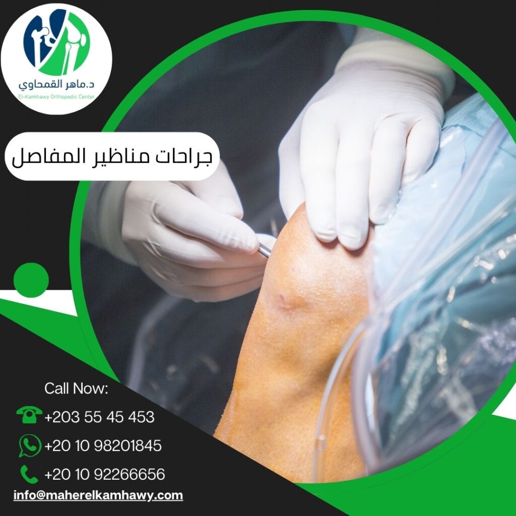 جراحات مناظير المفاصل في الإسكندرية – مع د. ماهر القمحاوي