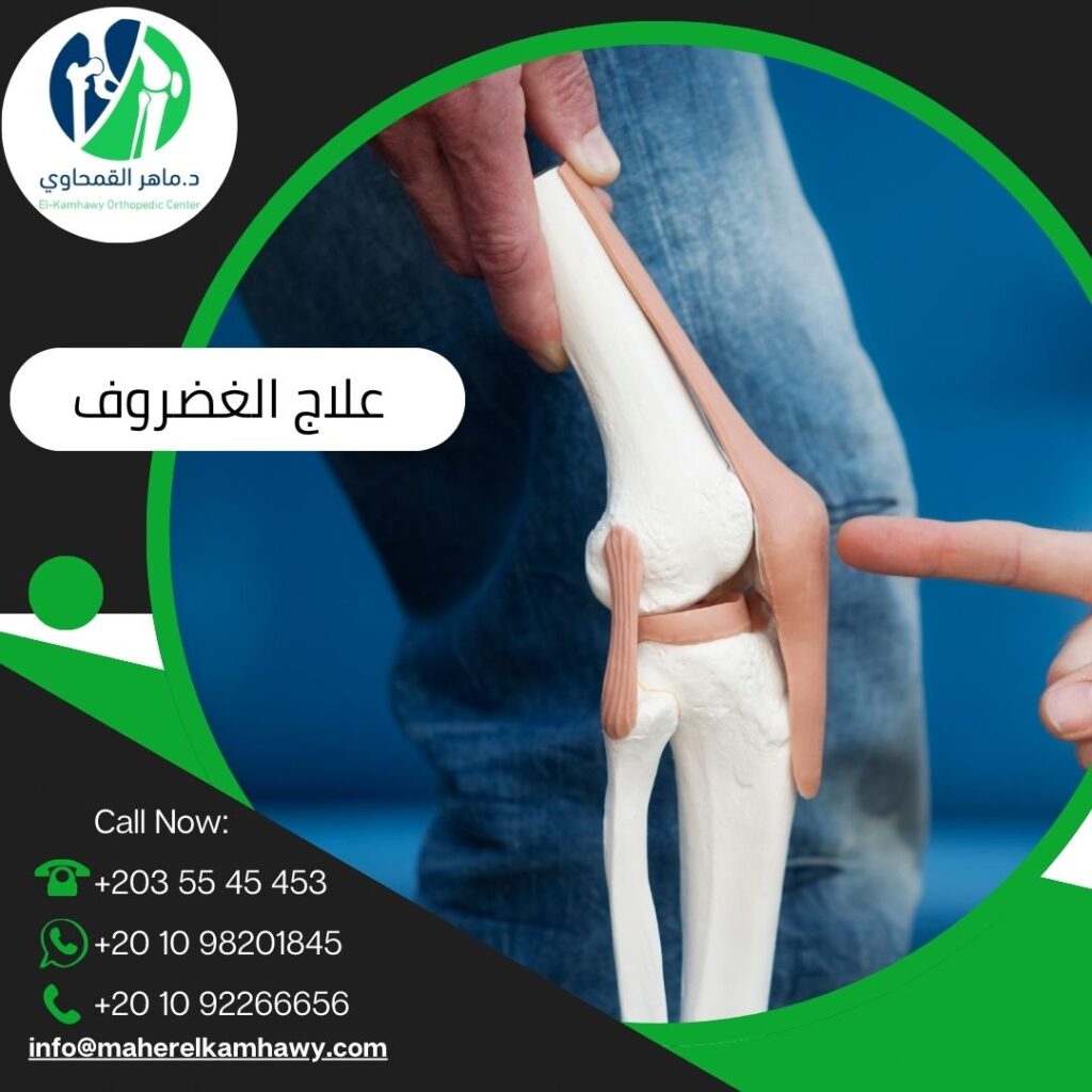 علاج الغضروف في إسكندرية