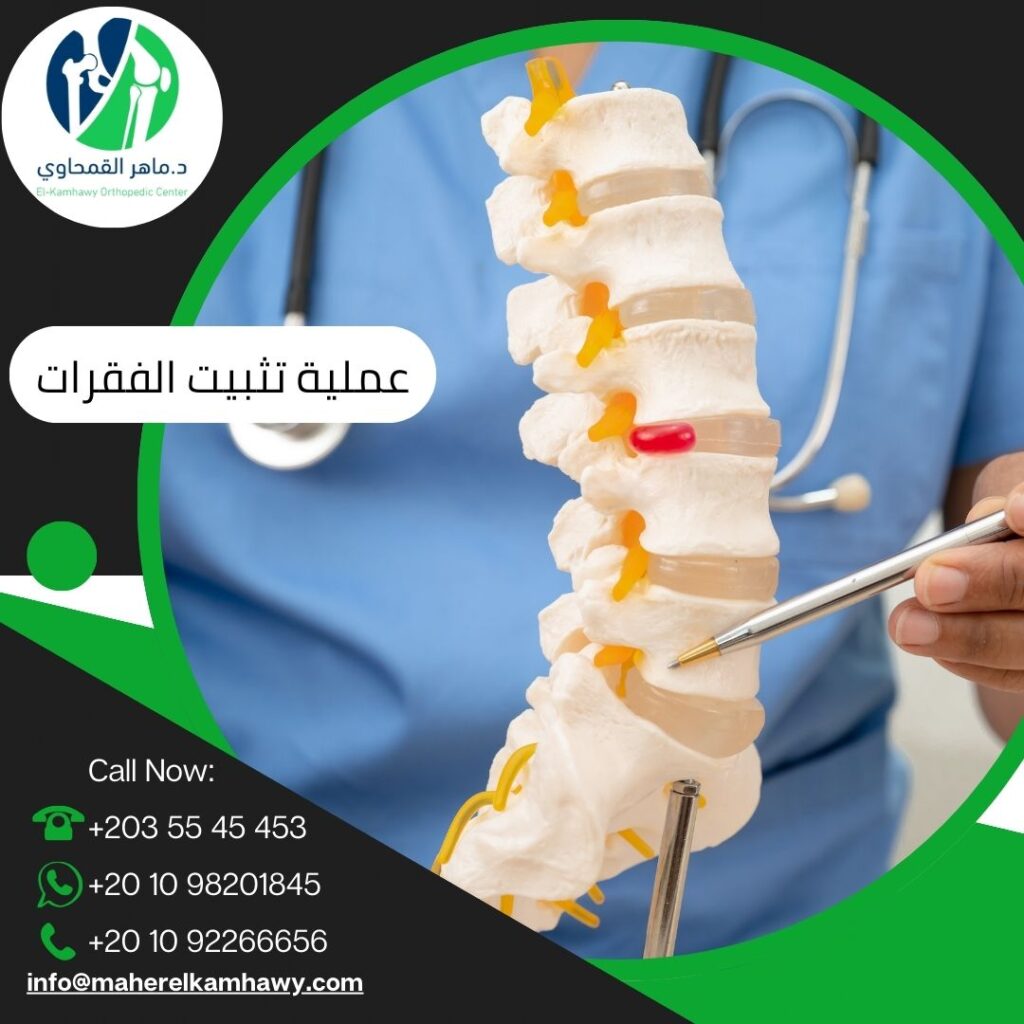 عملية تثبيت الفقرات