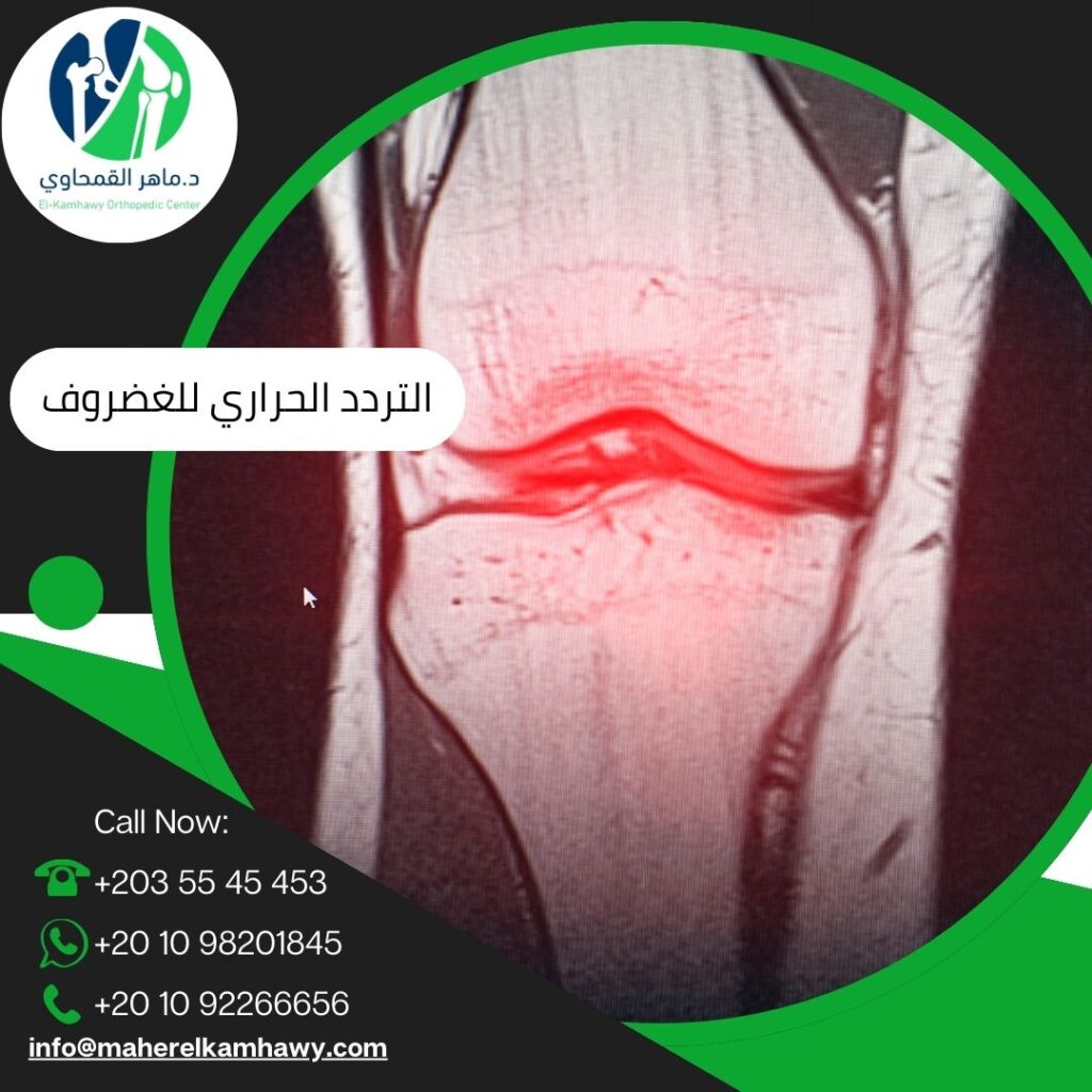 ما هو التردد الحراري للغضروف