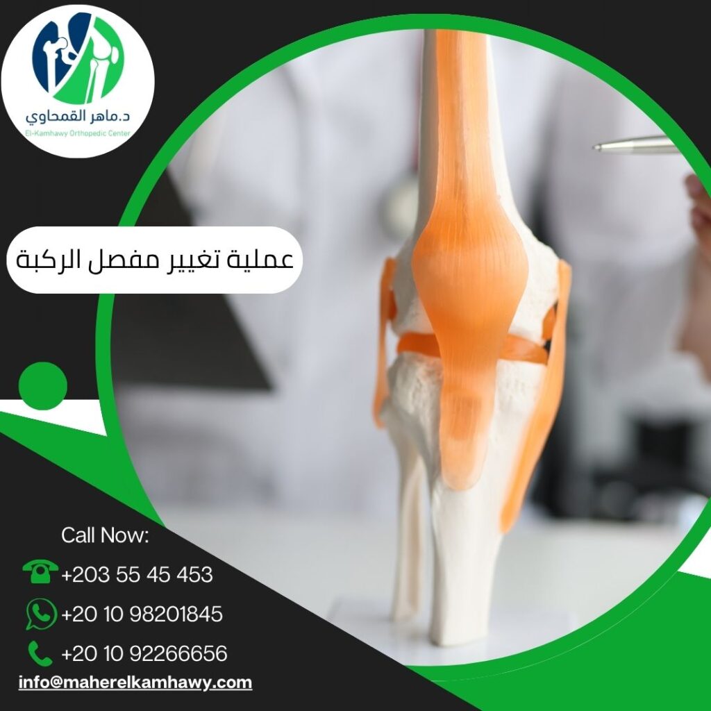 متى أحتاج إلى عملية تغيير مفصل الركبة؟
